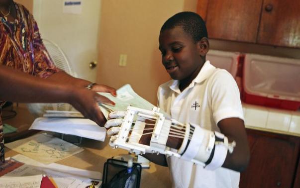 3D Printed Arm For Haiti boy
