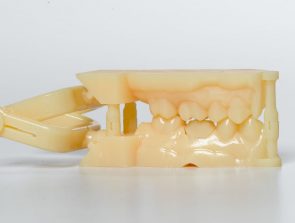 The Silent 3D Printing Revolution in Dentistry