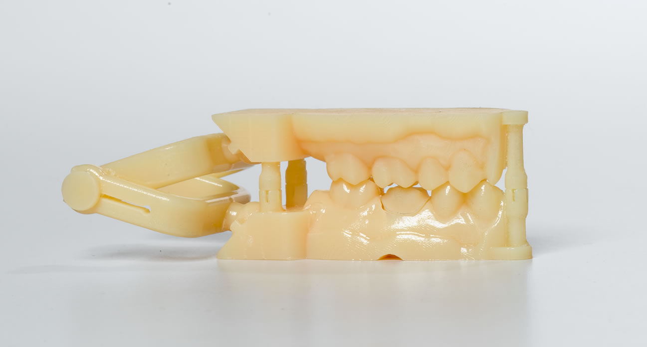 The Silent 3D Printing Revolution in Dentistry