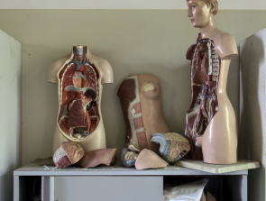 3D-Printed Organs: What They Are and Notable Milestones