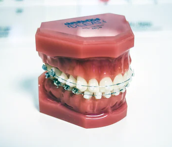 custom teeth