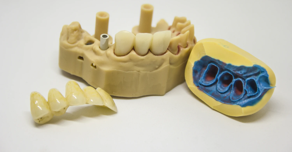 Dental 3D Printer: Reshaping Dentistry